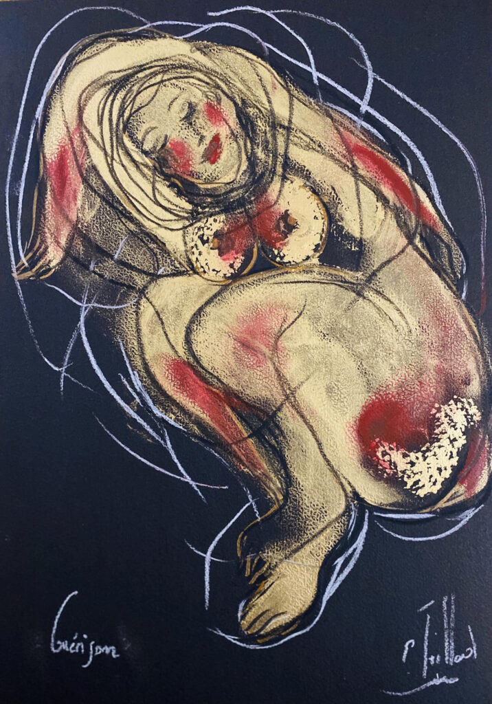 Guérison — œuvre d’Émilie Teillaud